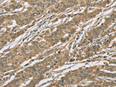 EIF3F Antibody