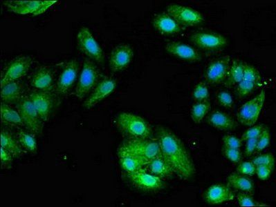 EIF3M Antibody