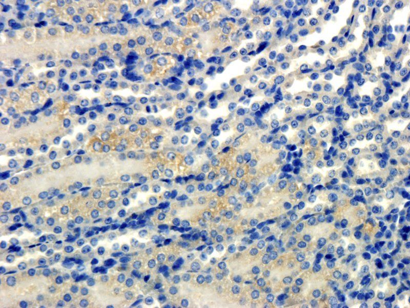 Elastin Rabbit Polyclonal Antibody