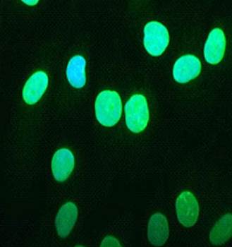 Emerin Monoclonal Antibody