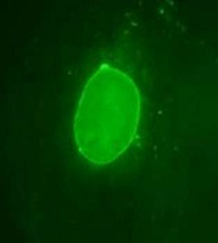 Emerin Antibody