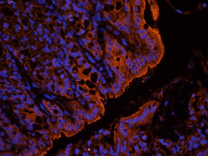 ENaC gamma Rabbit Polyclonal Antibody