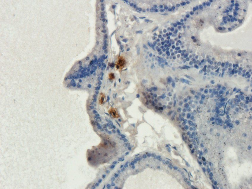 ENaC gamma Rabbit Polyclonal Antibody