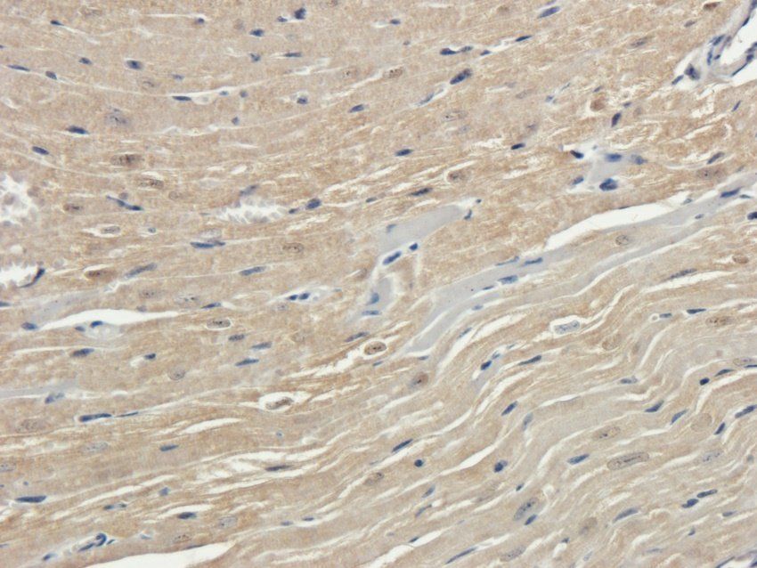 ENaC gamma Rabbit Polyclonal Antibody