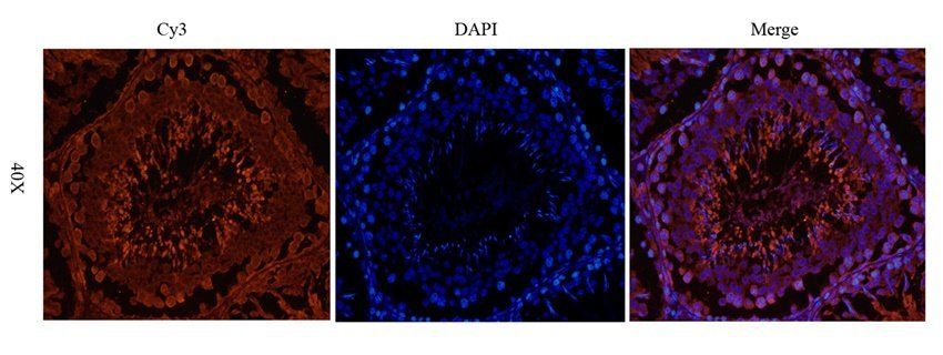 Enkephalin Rabbit Polyclonal Antibody