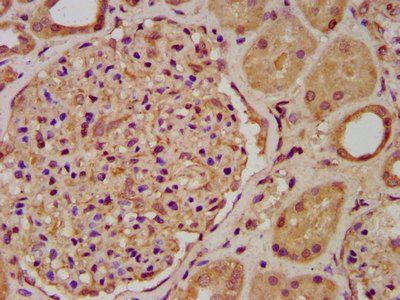ENOSF1 Antibody