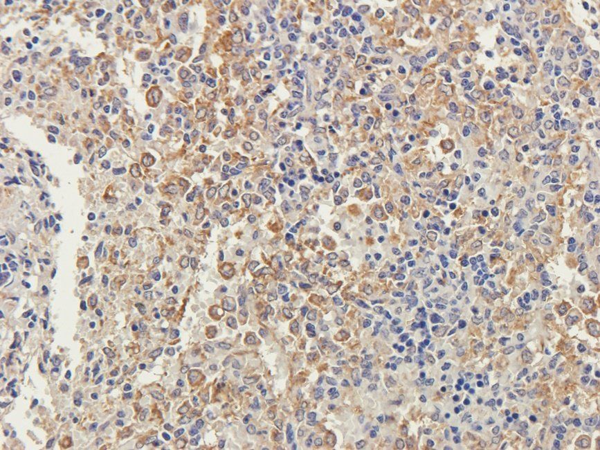 EPAS1 Rabbit Polyclonal Antibody
