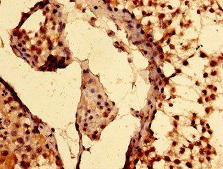 EPAS1 Antibody