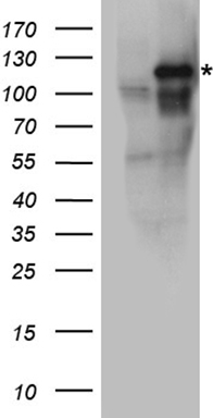 Eph receptor A3 Antibody