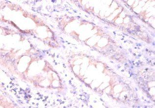 EPO Antibody