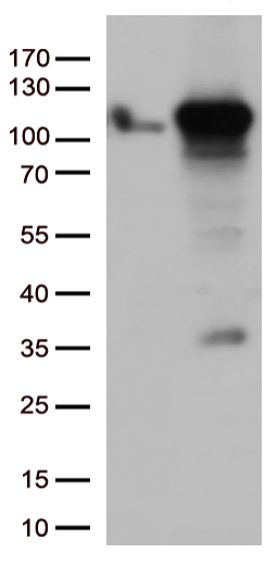 ESE1 Antibody