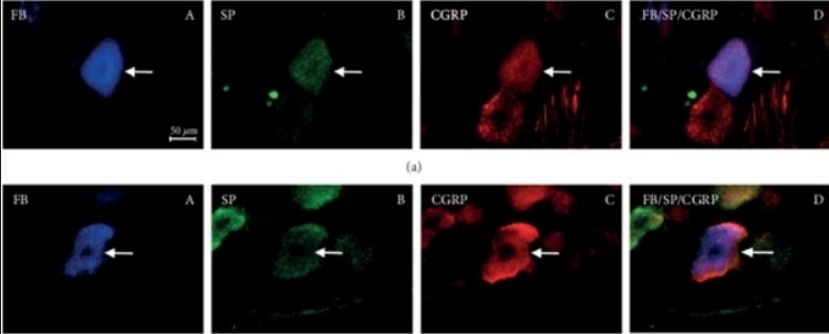CGRP Antibody