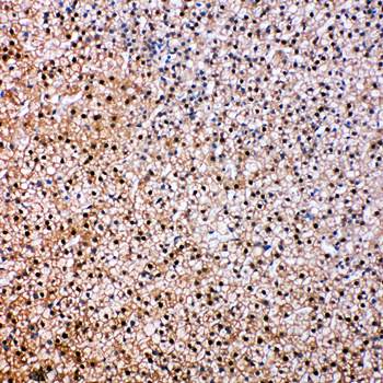 VCP Rabbit Polyclonal Antibody