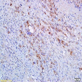 HLA-A Rabbit Polyclonal Antibody (HRP)