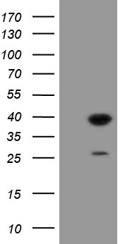 UBE2J1 Antibody
