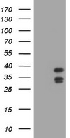 UBC6e Antibody
