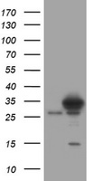 SRPR beta Antibody