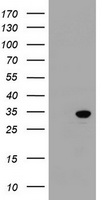 SRPR beta Antibody