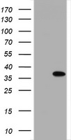 NANP Antibody