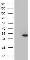 GSTO2 Antibody