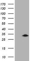 GSTO2 Antibody