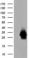 CRYM Antibody