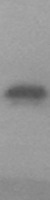 PINLYP Human Over-expression Lysate
