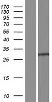 STEEP1 Human Over-expression Lysate