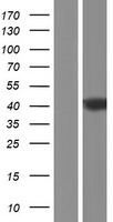 PCYT1B Human Over-expression Lysate