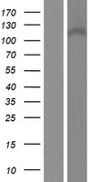 CCDC66 Human Over-expression Lysate