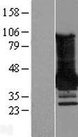 MAGEA4 Human Over-expression Lysate