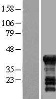 PEG10 Human Over-expression Lysate
