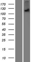 OTOA Human Over-expression Lysate