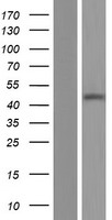 CD39 (ENTPD1) Human Over-expression Lysate