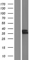 RAD51D Human Over-expression Lysate