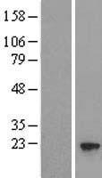 UFC1 Human Over-expression Lysate
