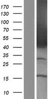 NR2F2 Human Over-expression Lysate