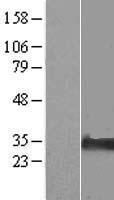 NIPA2 Human Over-expression Lysate