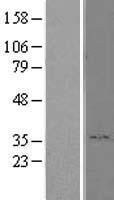 RHBDD1 Human Over-expression Lysate