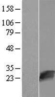 SDOS (NUDT16L1) Human Over-expression Lysate