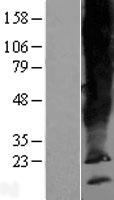 SCAMP5 Human Over-expression Lysate