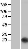 NUDT16 Human Over-expression Lysate