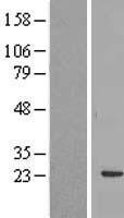 RBM24 Human Over-expression Lysate