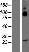 Amyloid Precursor Protein (APP) Human Over-expression Lysate