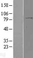 PPP2R1B Human Over-expression Lysate