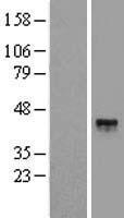 Cathepsin B (CTSB) Human Over-expression Lysate