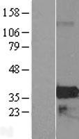 ZMAT4 Human Over-expression Lysate