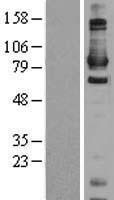 DAXX Human Over-expression Lysate