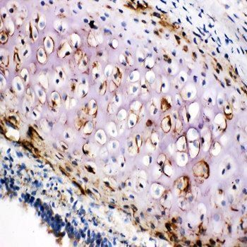 Collagen II/COL2A1 Rabbit Polyclonal Antibody