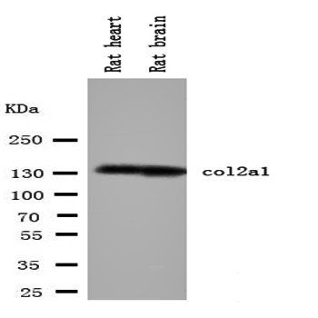 Collagen II/COL2A1 Rabbit Polyclonal Antibody